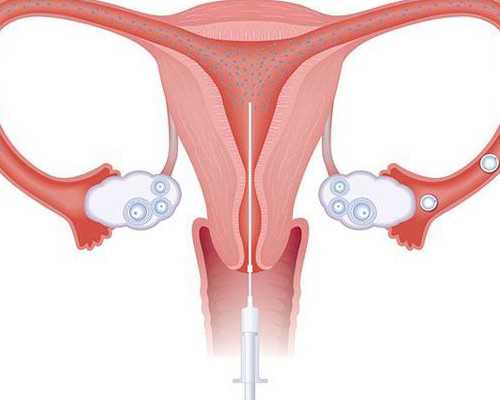 香港验血哪里可以做_刚测过的人来告诉你,香港验血y多是男孩吗