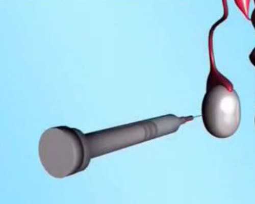 香港验血邮寄过去靠谱吗_香港验血哪家机构好_验男女真的会翻盘吗!