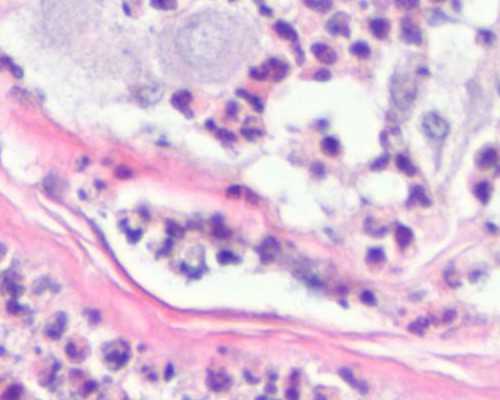 怎样找到正规的香港验血机构_产检看男女_测性别哪家化验所权威!