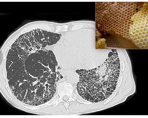 孕妇后期肚子疼是怎么回事,怀孕几周香港可以验血
