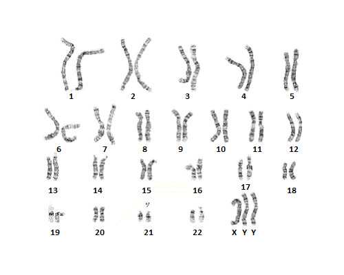 7788收藏古玩交易网下载飞机模型,肚子上的肉怎么瘦快