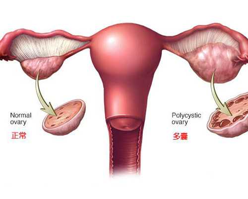 温州医院香港验血,备孕前女人喝什么牛奶