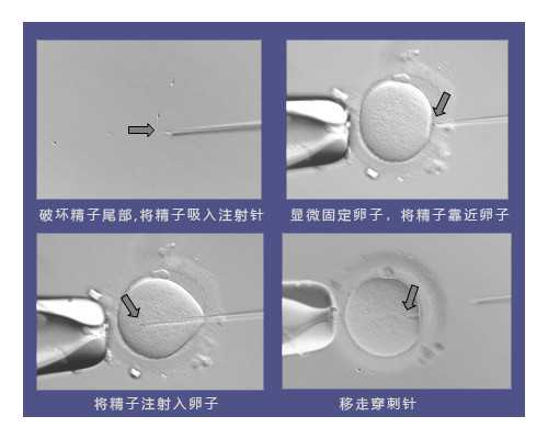 沉浮古玩虫全集免费观看,码住｜开发信被拦截可以这样做