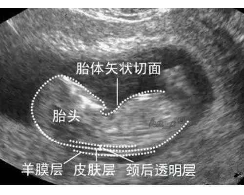 中国古董古玩交易中心,冬日6个呼啦圈招式