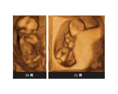 香港验血检查贵不,试管是如何评估胚胎质量的?试管前调理身体!