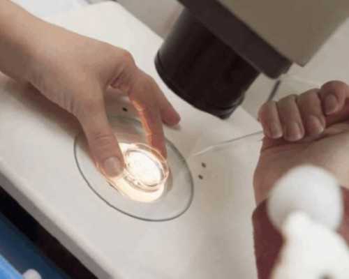 香港验血3300块钱_香港验血机构查询准不准_19周验血B超翻盘信哪个