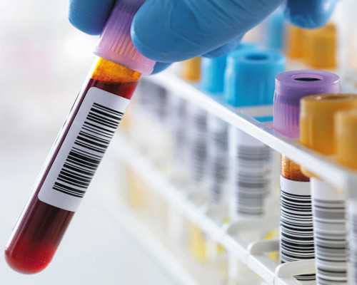 香港合法的验血机构_看看生过的宝妈怎么说的 香港验血告诉你是女儿打了就不