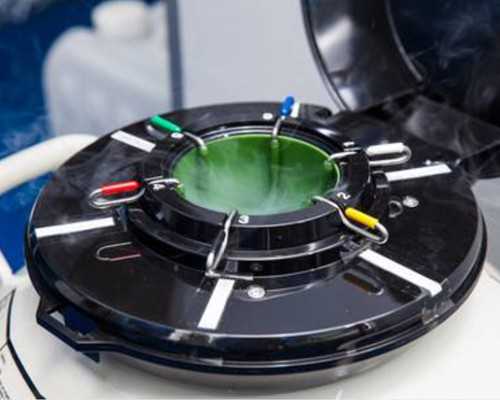 香港验血马上知道结果的准吗,54岁绝经5年想做供卵试管，请问54岁没有月经借卵