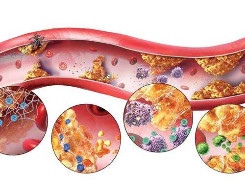 邯郸古玩城,如何加快产后女性瘦身