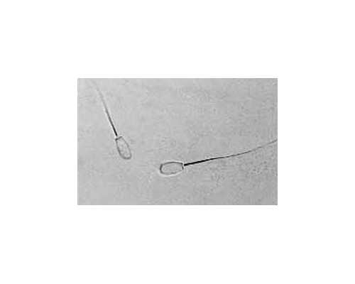 香港验血经常不准,月经期、卵泡期、排卵期、黄体期的区别