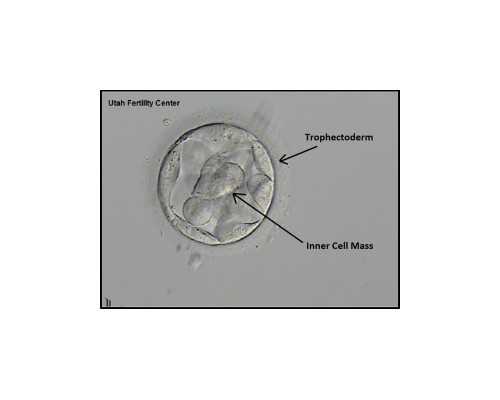 香港可以验血费用大概是多少_香港验血报告怎么看？我的经历告诉你是不是被