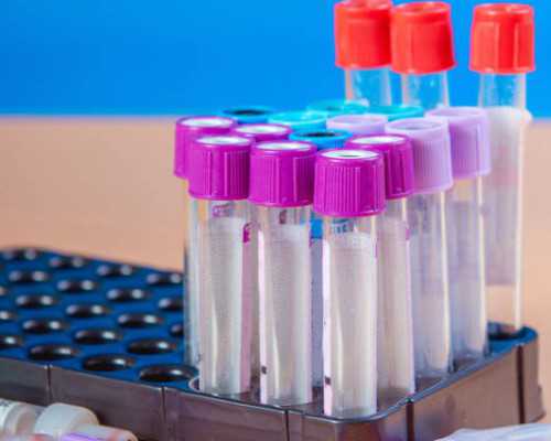 香港验血邮寄怎么担保,子宫后位会影响试管婴儿胚胎着床吗?