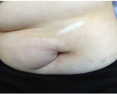 香港验血查男女去哪家好
 记者揭秘：香港验血准确率排行榜？正规机构联,有香