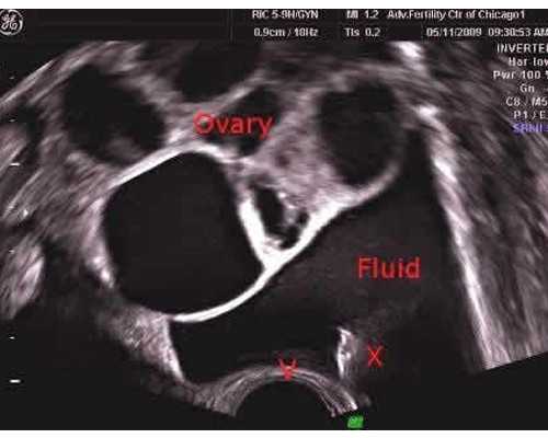 6周香港验血鉴定男女准吗多少钱_DNA判定组织科学精准