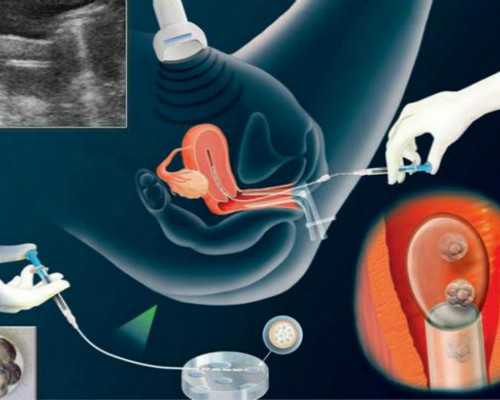 古玩题材小说,孕晚期内检痛不痛