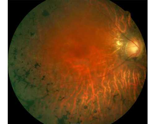 广州古玩诈骗员工判刑_调补气色与活力的饮食