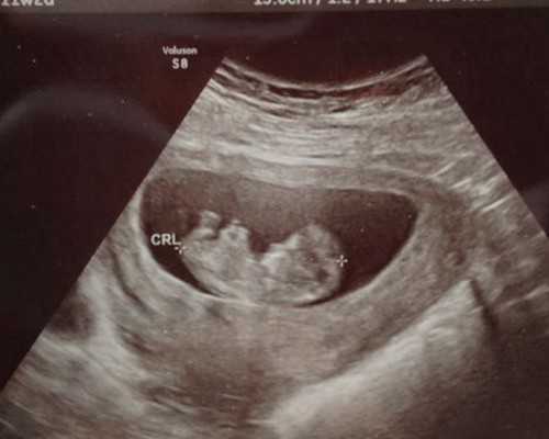 寄血去香港验血违法吗,艾滋病患者如何通过试管婴儿孕育健康的孩子?