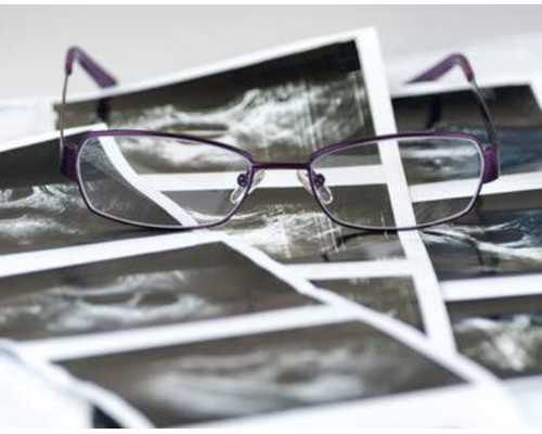 香港验血生男生女费用多少,月经期间可以用痔疮膏吗使用痔疮膏一定要注意这