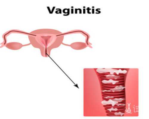 过避孕药香港验血准吗,台湾做试管婴儿要结婚证吗？台湾试管婴儿可以选男女