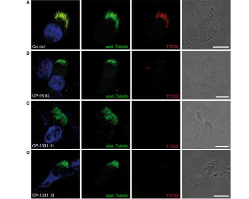 香港验血把血寄到香港会变质吗_香港正规的验血机构?告诉你香港验血是不是骗