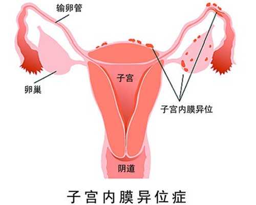 香港寄血验血骗局,抽血检查不孕不育四项女性不孕治疗新方法