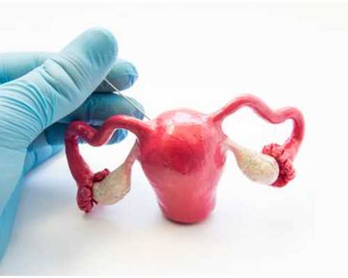 怀孕50天香港验血,巧囊加子宫腺肌症做试管婴儿成功率怎么样?