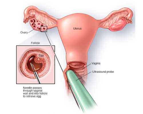 古玩人生顾靖与邹月娥,中晚年运势变好的八字四大特征