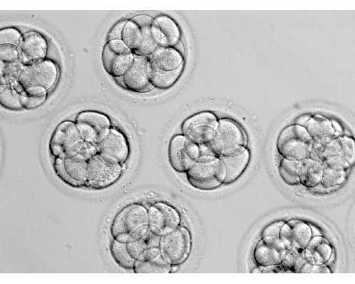 怀孕香港验血查的有y染色体,试管备孕食谱来袭，吃得好，试管才更好！