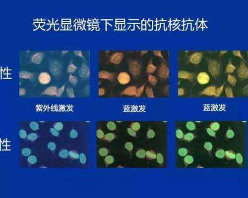 ,香港验血鉴别胎儿多少钱