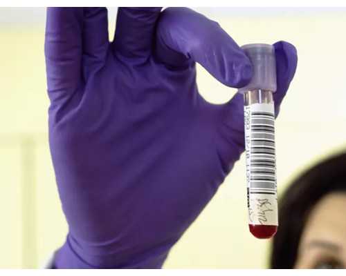 胎停后香港验血还能查男女,支原体感染对做泰国试管婴儿有影响吗？