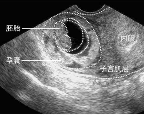香港验血鉴定mk多少钱_哪里有验血检测科学精准