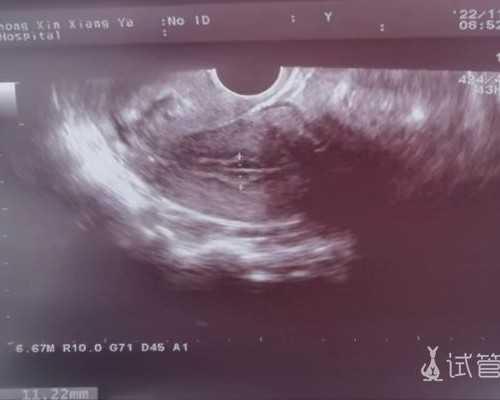 香港验血1600元可以吗,马来西亚生丰医院试管治疗套餐最低6万元起靠谱吗？