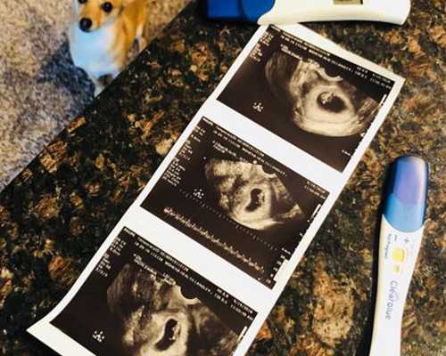 香港验血有哪几家大权威机构_十年来无一个错误,香港五周验血准吗