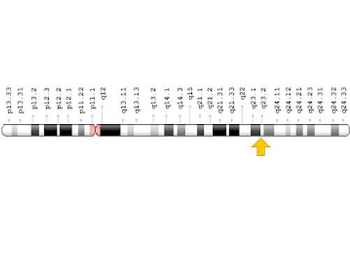 老古玩店故事梗概,如何挽回巨蟹男