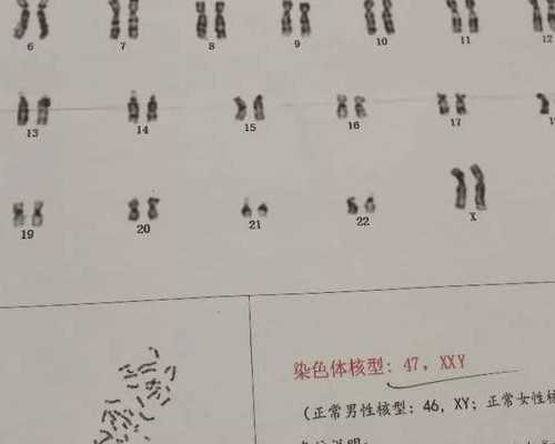 香港验血验男女费用,去香港验血查胎儿性别胚胎要多大_查胎儿性别要多少钱