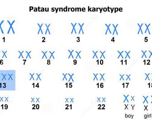 沉浮古玩虫第二集,长期服用助睡眠的药后果是什么