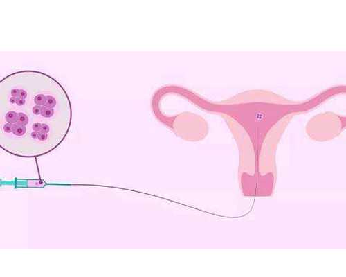 古玩人生免费听,颧骨内推是磨骨吗