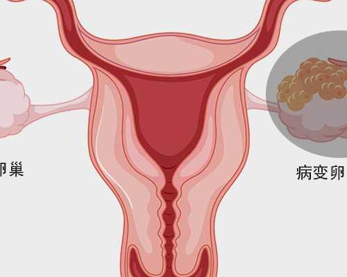 去香港验血查男女多少钱,泰国试管婴儿费用是多少，妈妈都引荐套餐了解一下