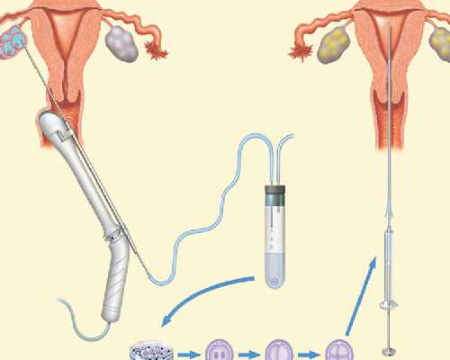 孕早期去香港验血准吗,管婴儿男方也要备孕？提升精子质量菜谱