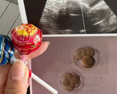 正规的检测验血部分寄检服务,香港验血男有不准的那吗