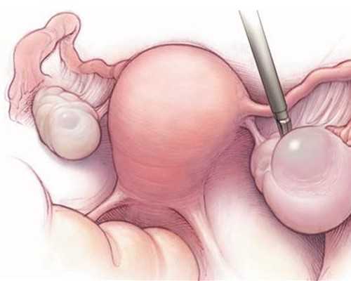 怀孕多久 香港验血测男女,香港验血测胎儿性别准确_验血查性别有什么需要注意