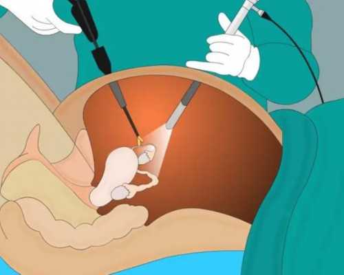 大理下关古玩市场,减肥有啥好方法