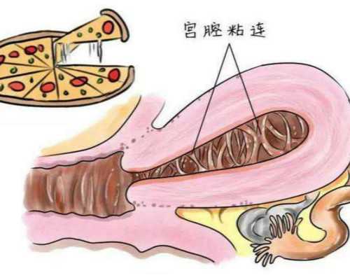 去香港验血的费用,现在香港验血检查男女_选择哪家化验所好!