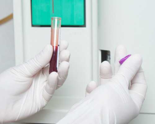 香港验血邮寄要三天,试管移植后14天内食谱-一位双胞胎妈妈的分享