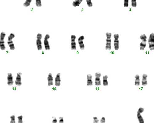 香港验血要寄几管血,专家解析：女性患有巧囊能去海外试管婴儿吗？