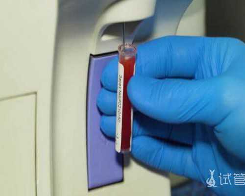 香港验血男女是空腹血吗,备孕怎么测基础体温