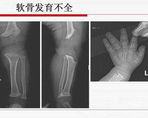 八周香港验血可以验出男女吗
香港做试管可选择性别吗?找权威化验所来帮你