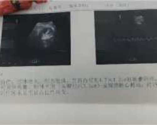 香港验血四大权威机构分别是哪几家，检测结果会有错吗,香港验血报告单图男