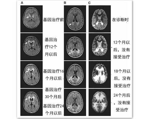 香港验血测y费用,香港验血应该注意什么意思_胎儿性别鉴定会不会翻盘!