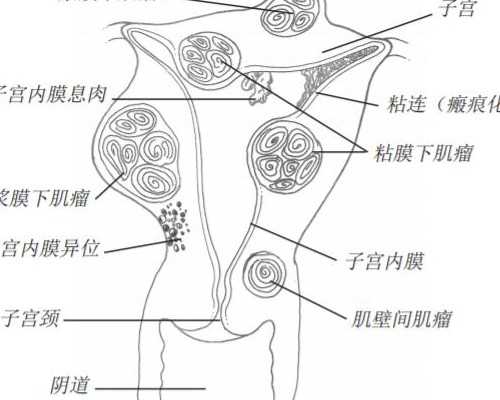 香港孕早期验血需准备什么,香港通过验血能确定生孩子性别吗_抽血查性别是真